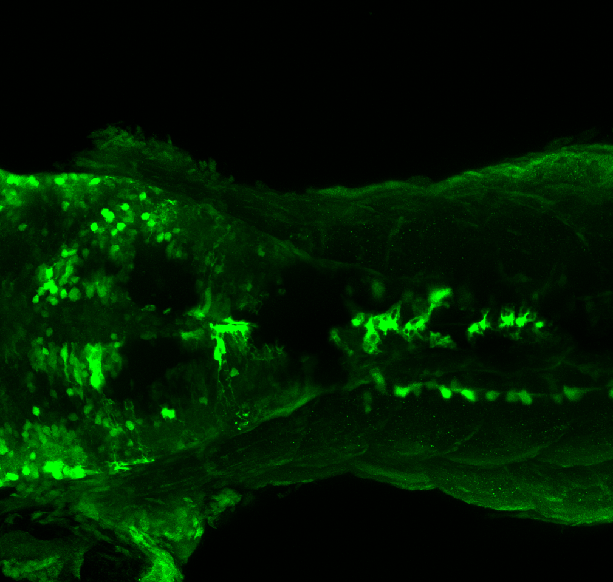 TG44:EGFP dorsal view at 4dpf