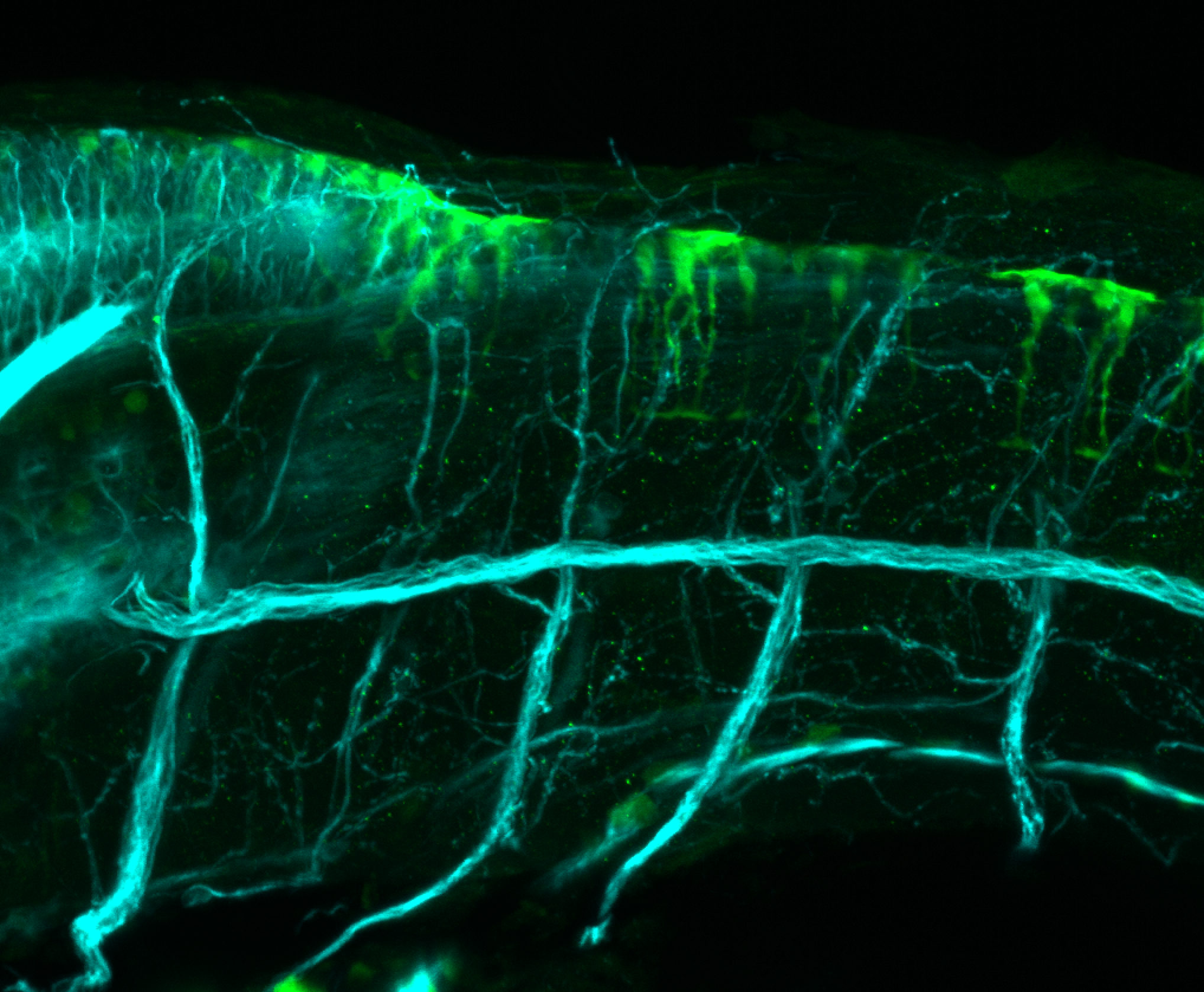 TG44:EGFP and tubulin lateral view at 4dpf