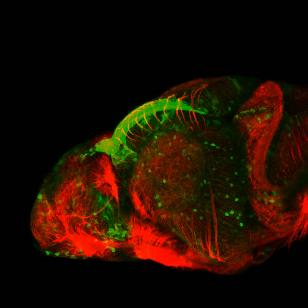 TG44:EGFP and tubulin lateral view at 4dpf