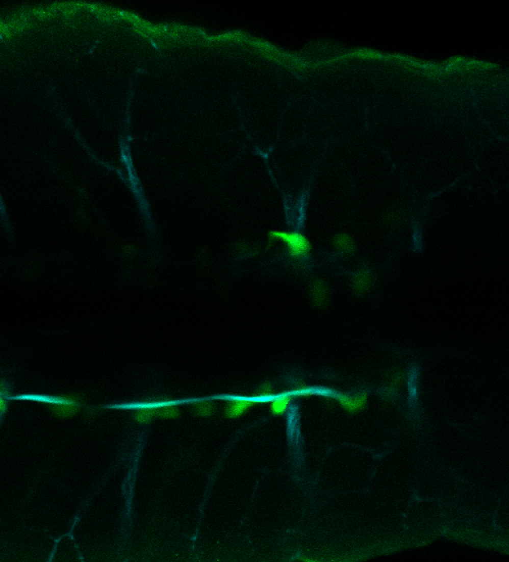 TG44:EGFP and tubulin dorsal view at 4dpf