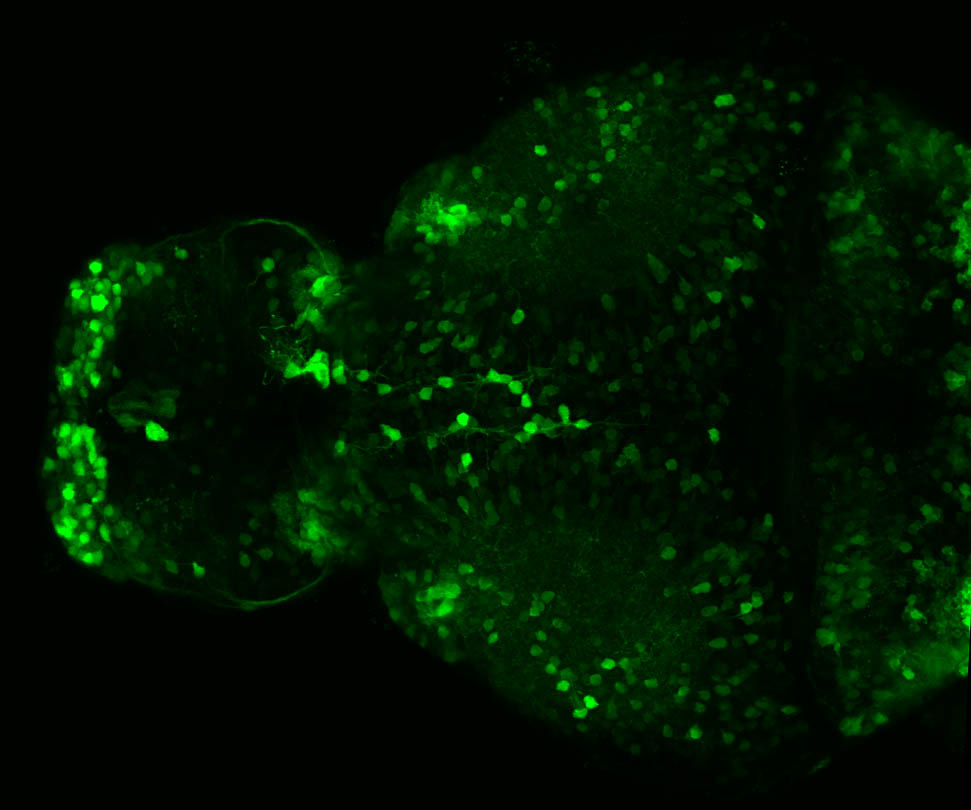 VKET11:EGFP dorsal view 4dpf