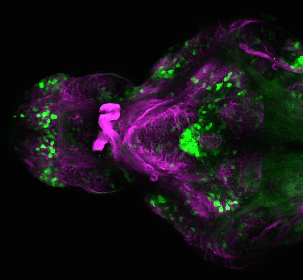 VKET11:EGFP and tubulin ventral view 4dpf