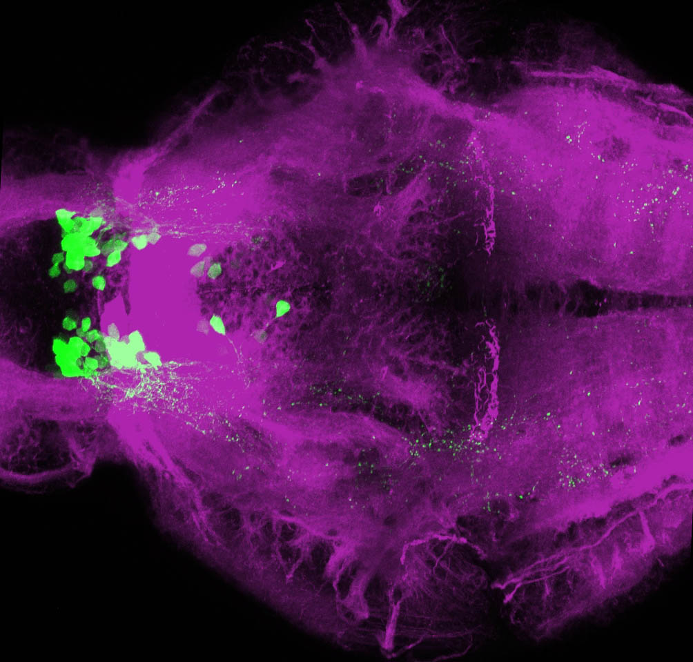 Ventral view of 4dpf Tg(oxt:GFP) with tubulin