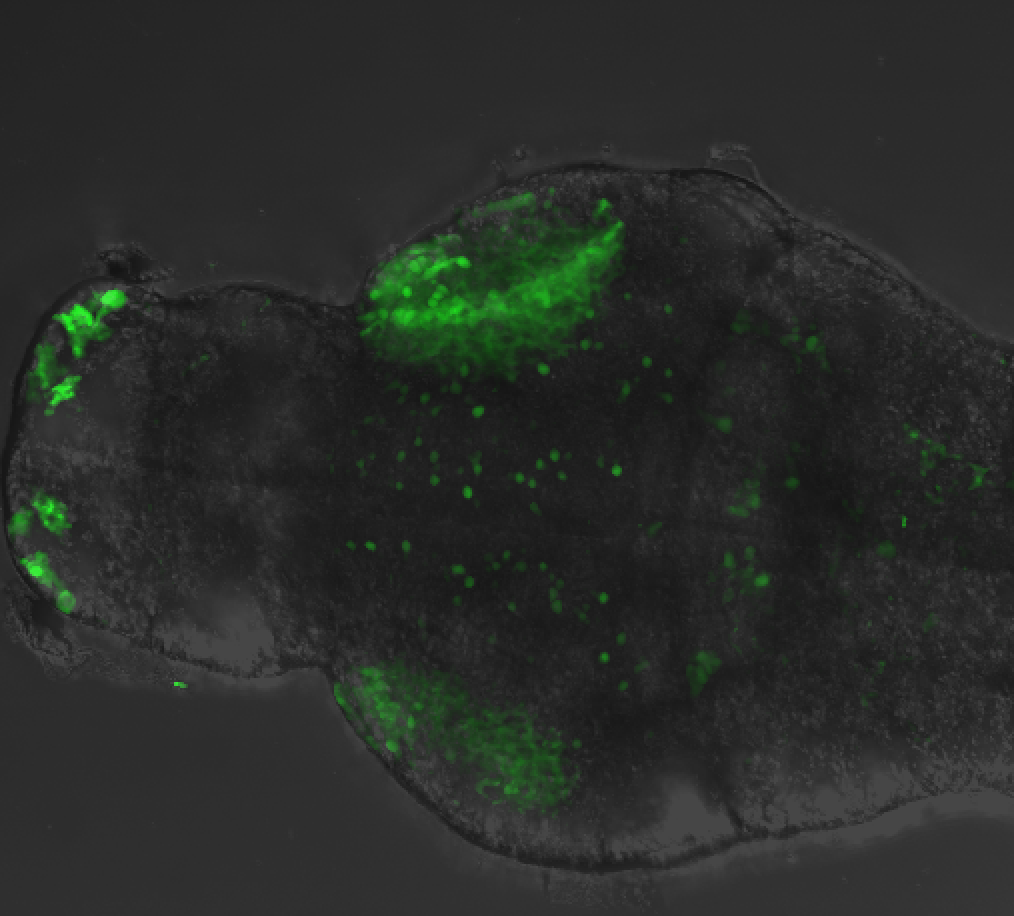 Dorsal 4dpf anti-Calbindin and DIC