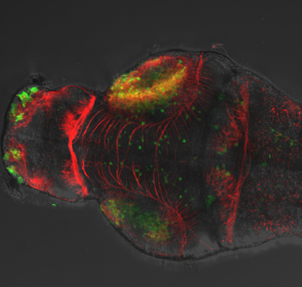 Dorsal 4dpf anti-Calbindin, anti-tubulin and DIC