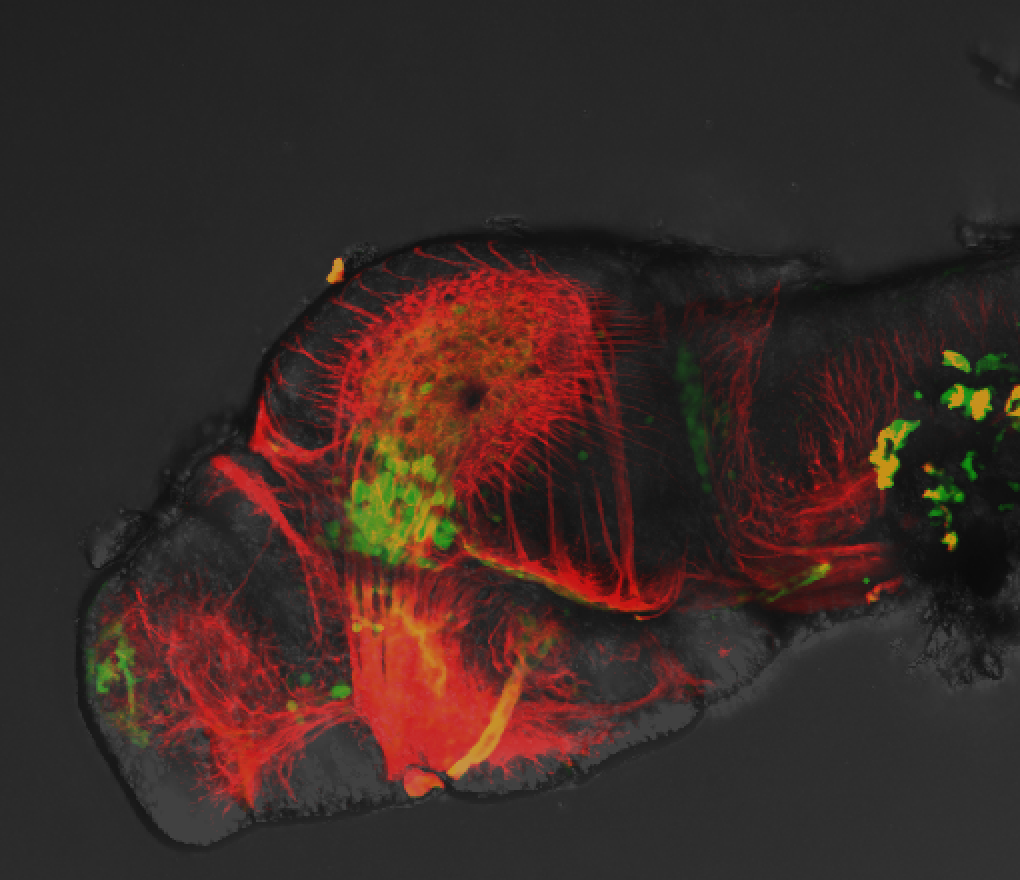 Lateral 4dpf anti-Calbindin, anti-tubulin and DIC