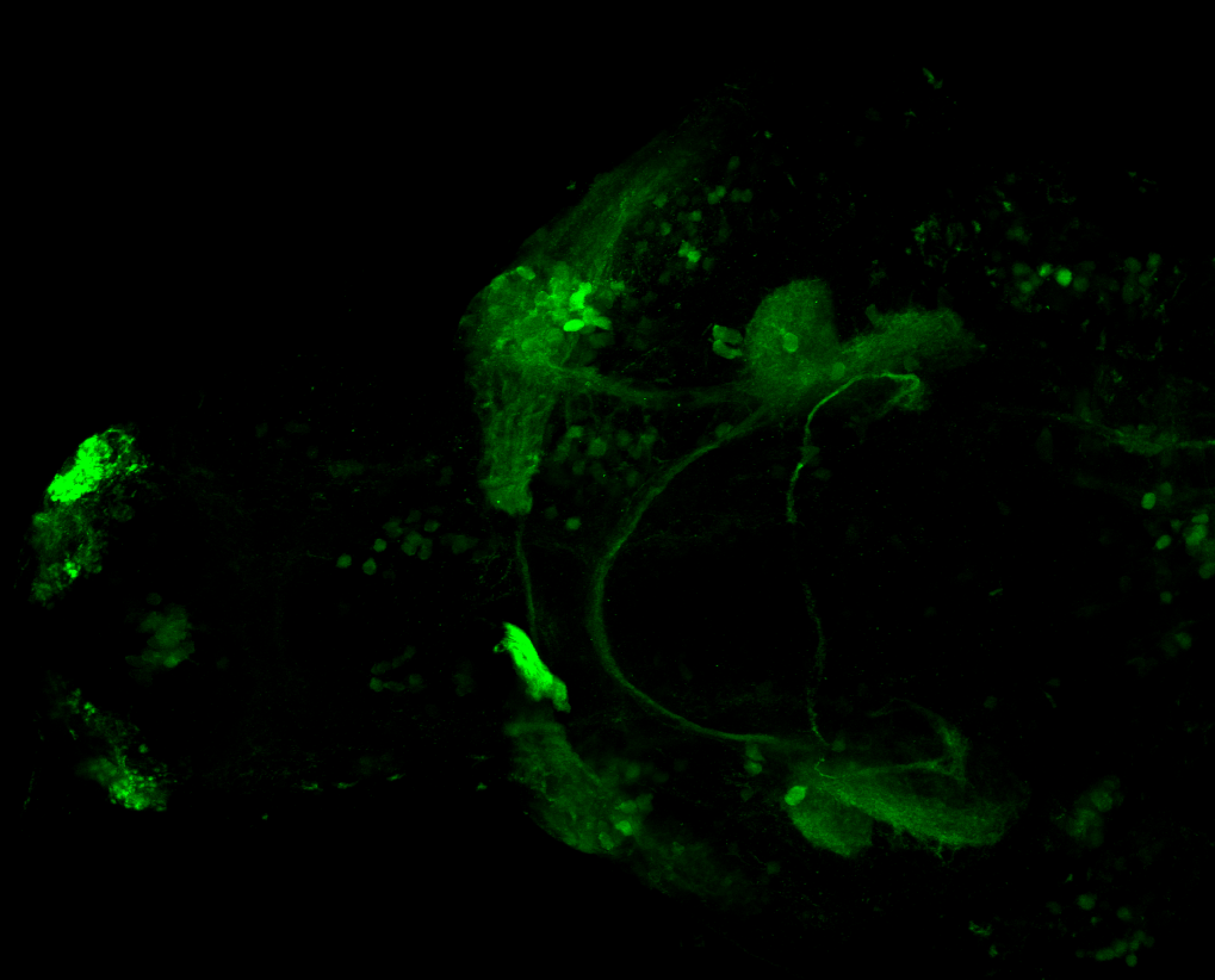 Ventral 5dpf anti-Calbindin
