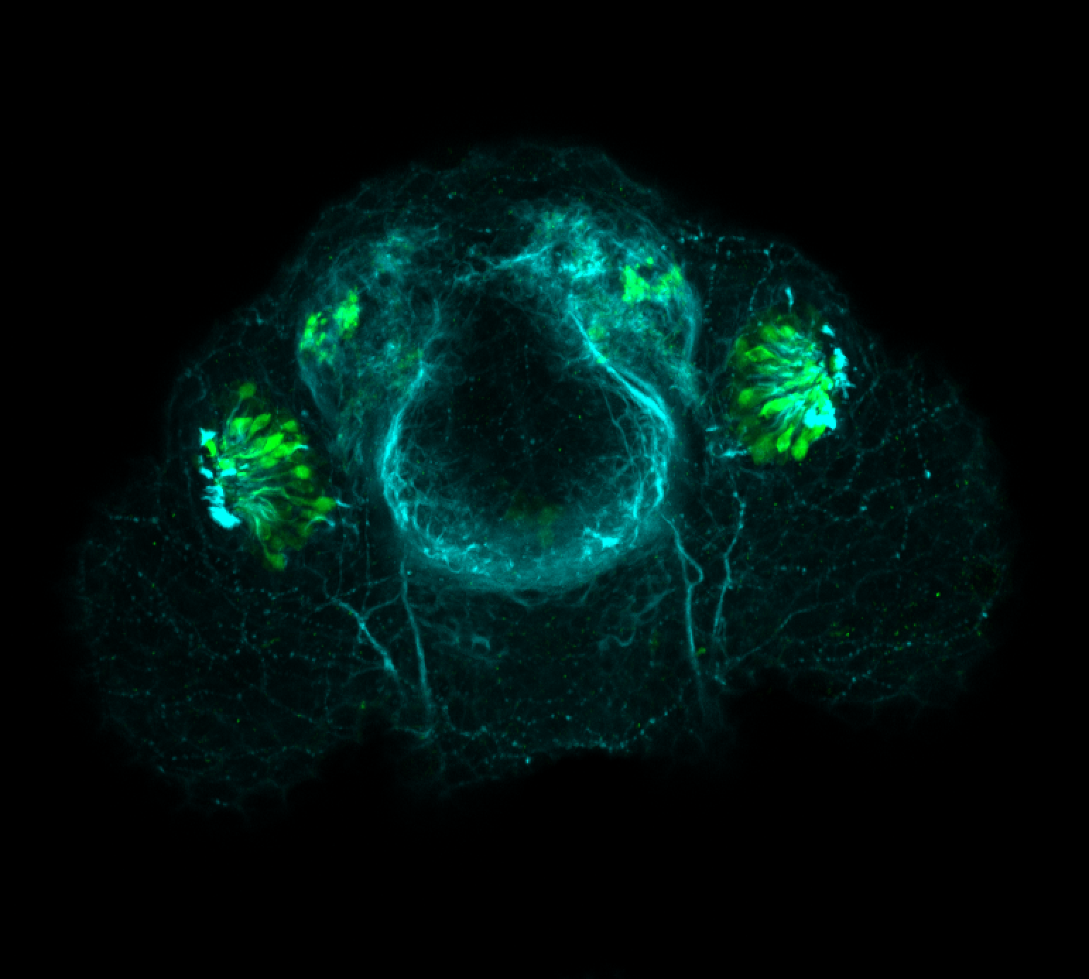 Frontal view 48hpf:anti-Calbindin and anti-tubulin