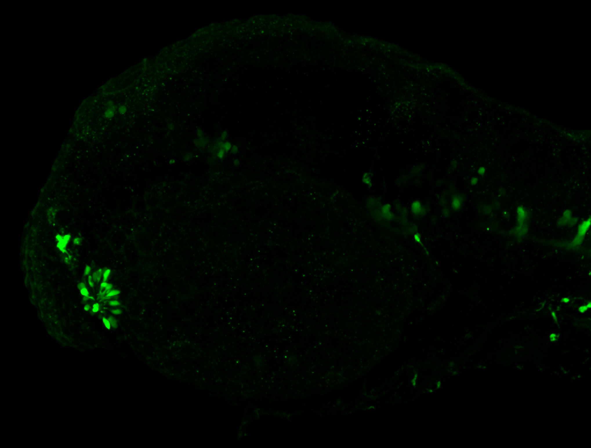 Lateral view 48hpf:anti-Calbindin 