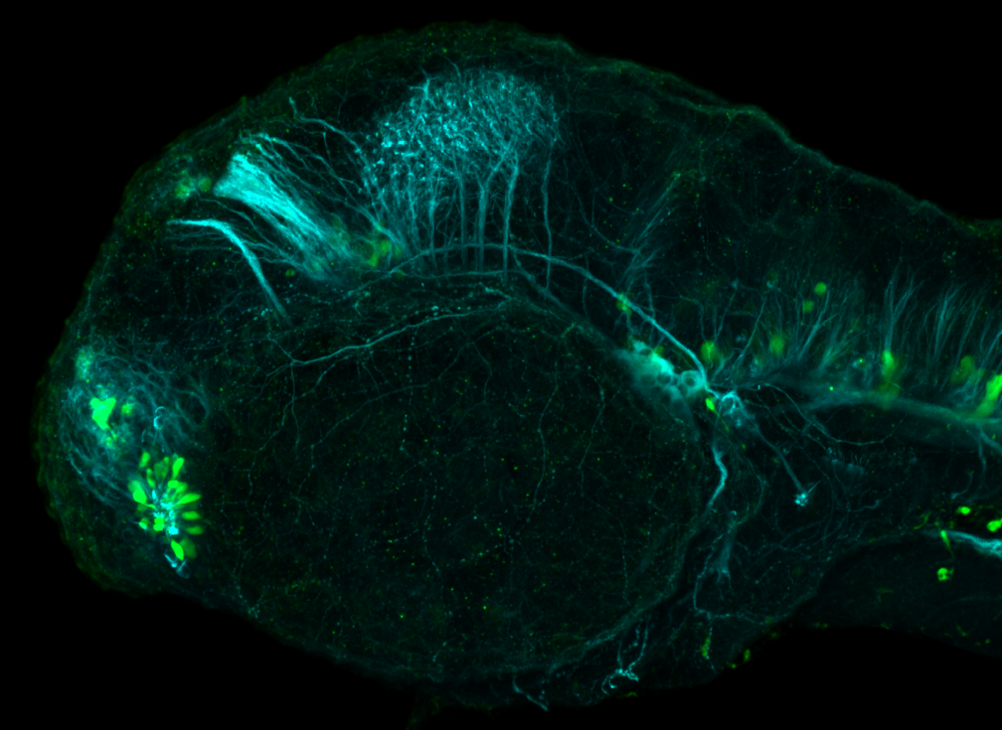 Lateral view 48hpf: anti-Calbindin and anti-tubulin