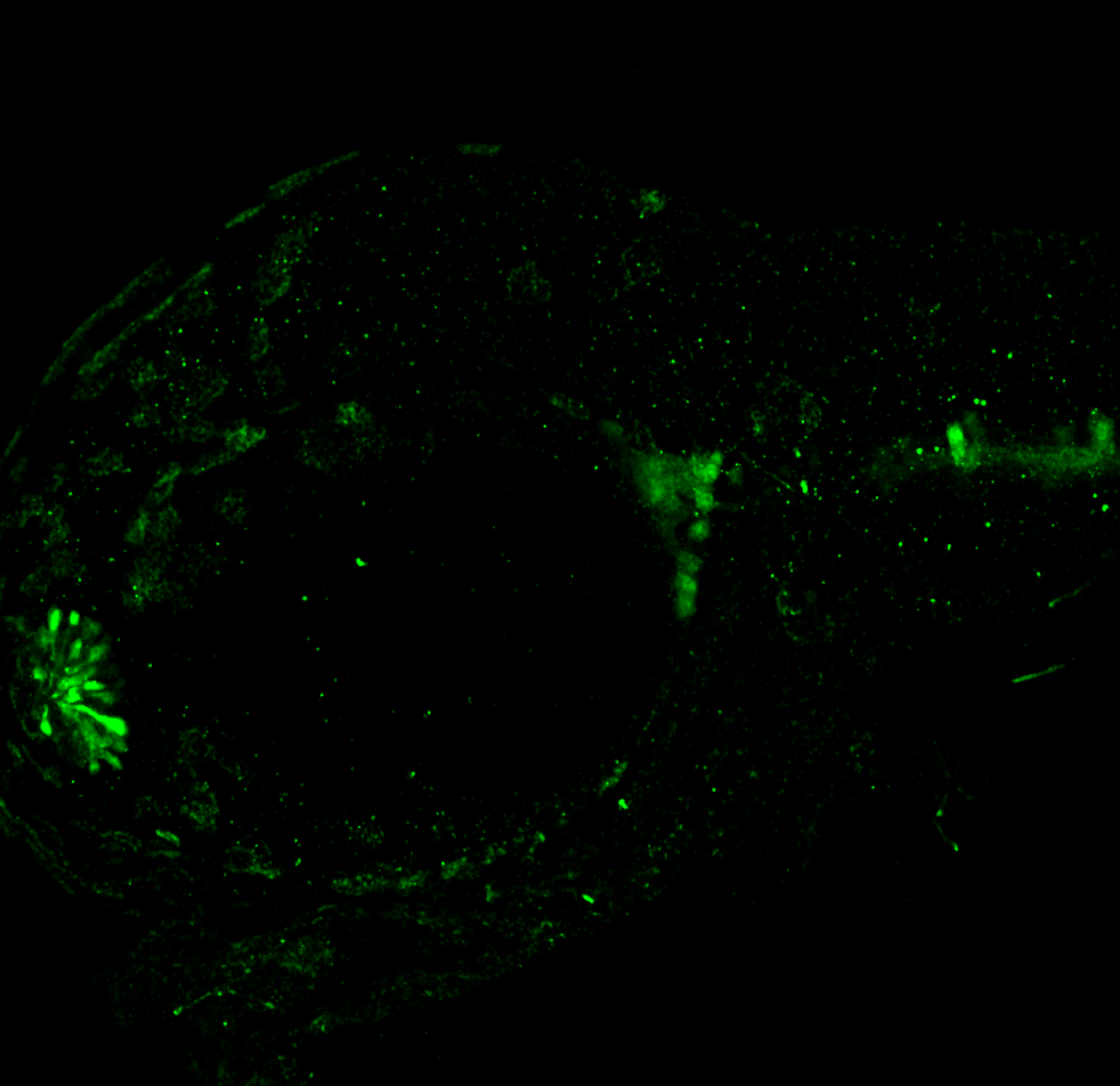 Lateral view 48hpf: anti-Calbindin trigeminal nerve expression