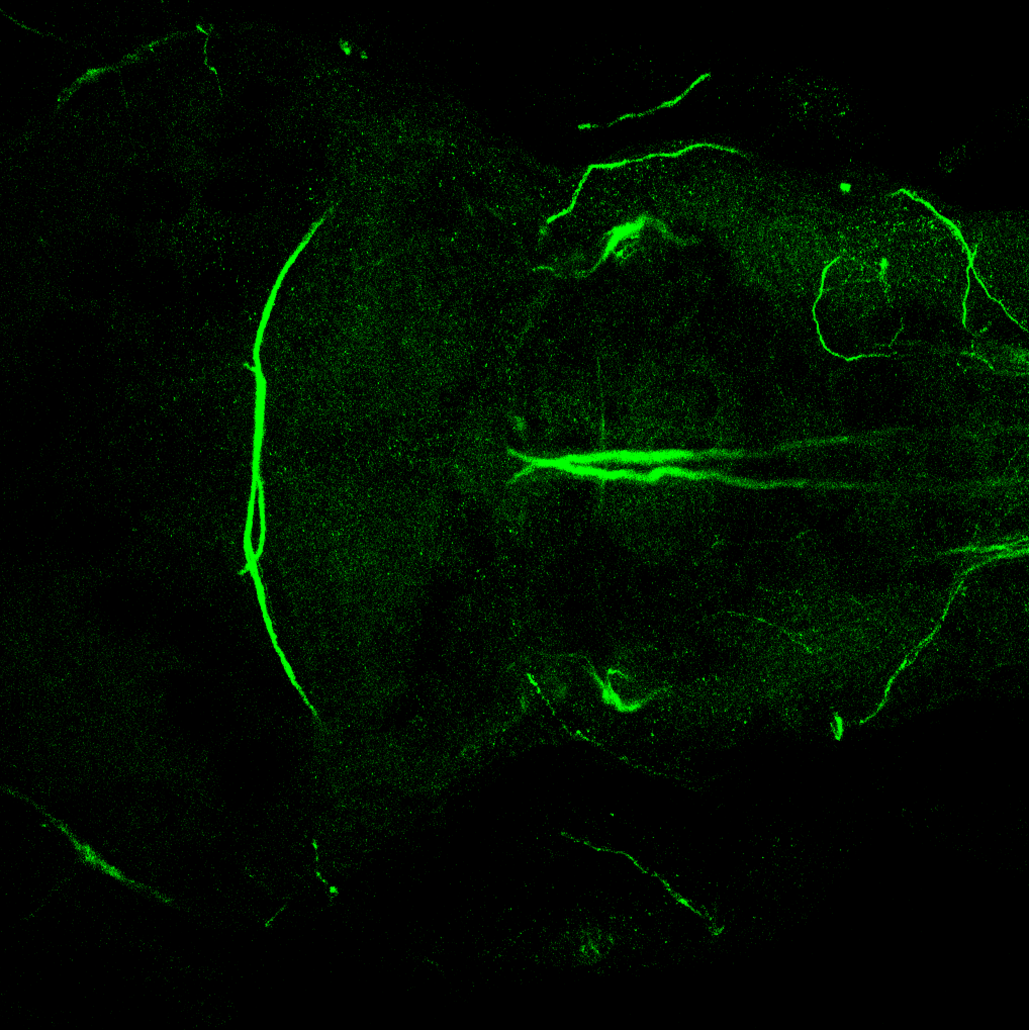 Dorsal view 5dpf of 3A10 antibody