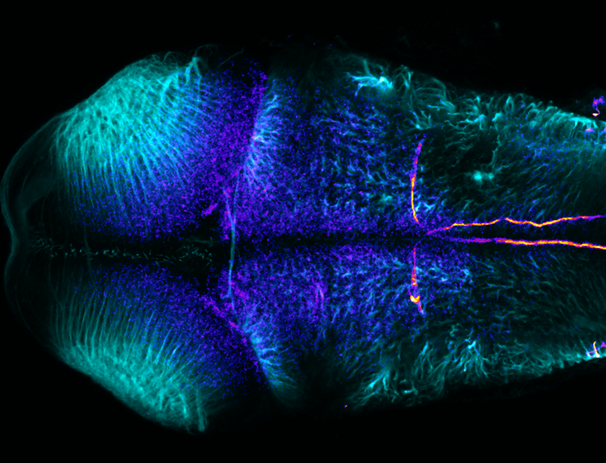 Dorsal view 4dpf 3A10(FIRE) and anti-tubulin(cyan)