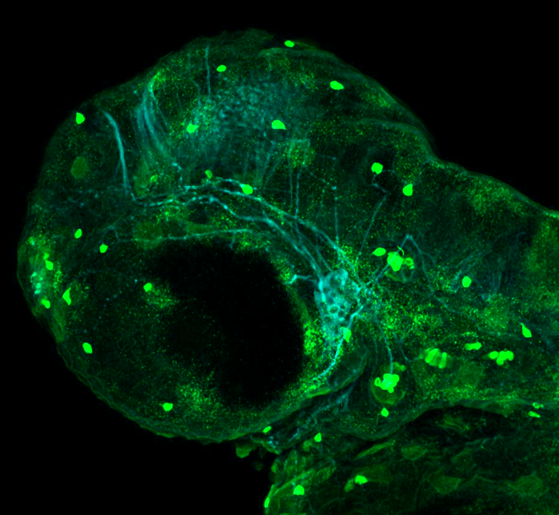 2dpf lateral parvalbumin and tubulin(cyan)