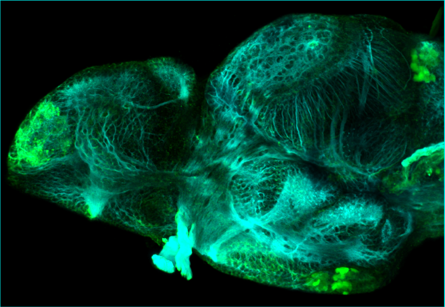 5dpf lateral parvalbumin and tubulin(cyan)