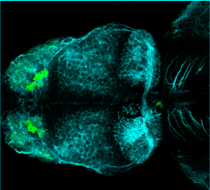 5dpf dorsal parvalbumin and tubulin(cyan)