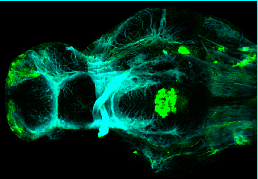 4dpf ventral view parvalbumin and tubulin(cyan)