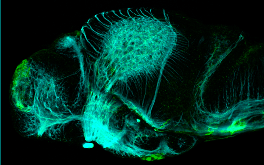 3dpf lateral view parvalbumin and tubulin(cyan)