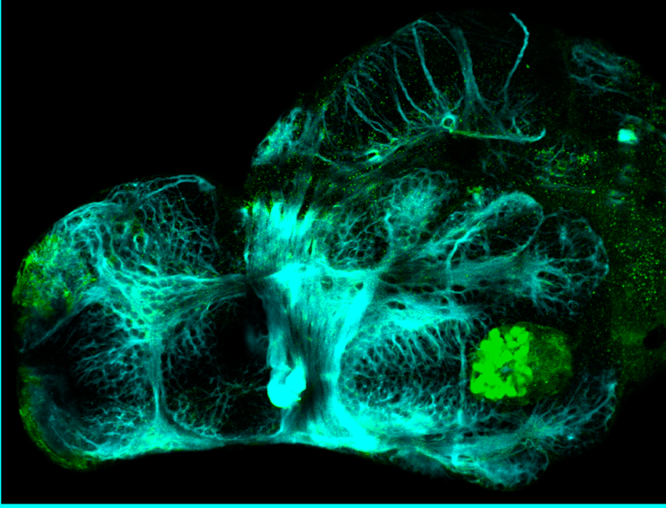 3dpf ventral view parvalbumin and tubulin(cyan)