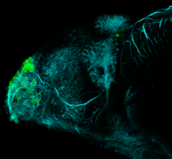 4dpf lateral view parvalbumin and tubulin(cyan)