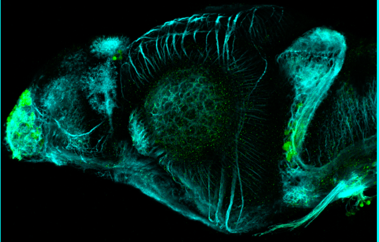4dpf lateral view parvalbumin and tubulin (cyan)