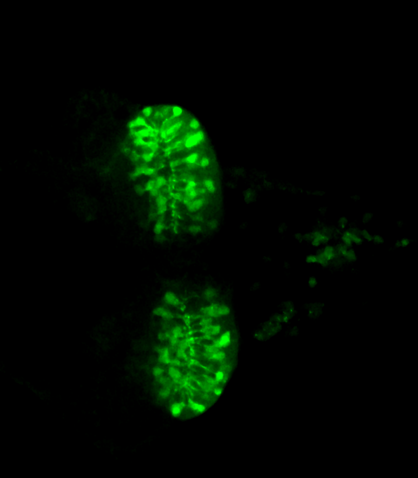 5-HT 3dpf ventral view hypothalamic lobes