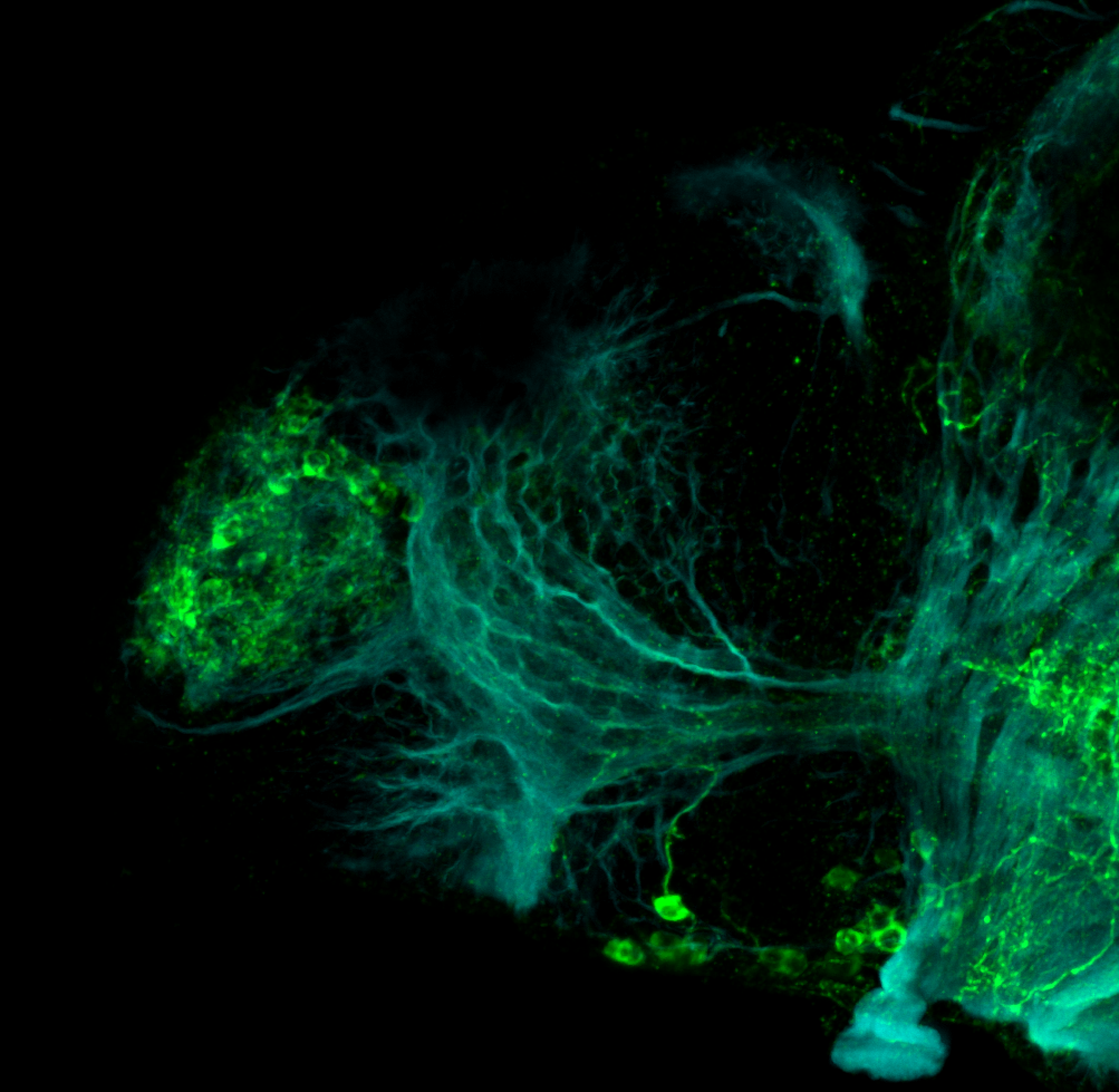 5dpf lateral anti-TH and tubulin(cyan)