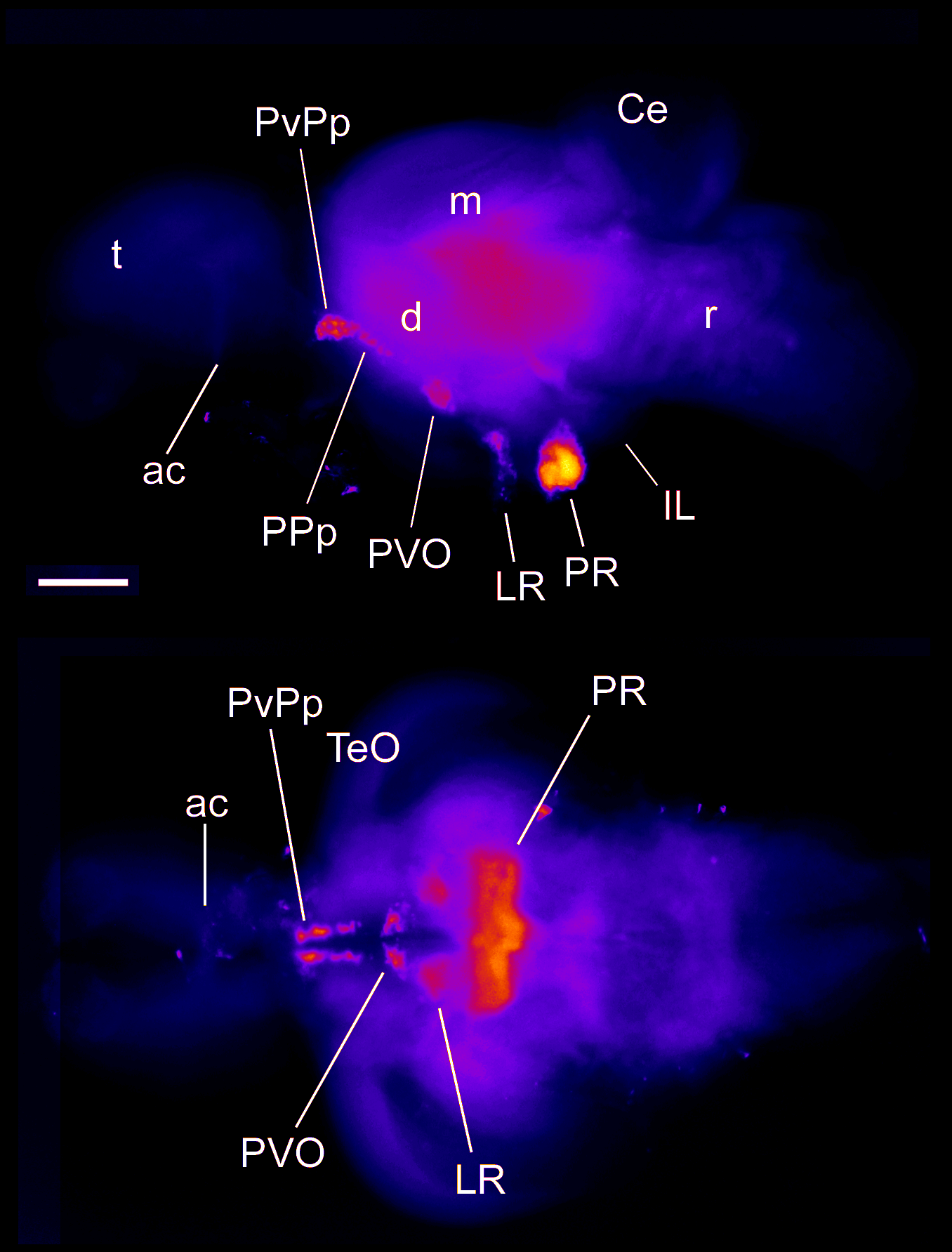 catecholaminergic neurons
