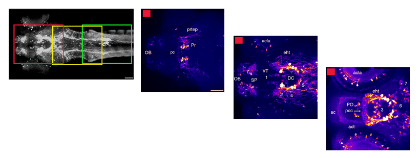 forebrain dopaminergic neurons 3dpf