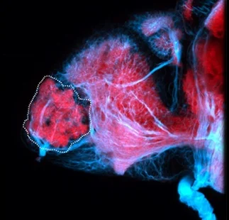 Lateral view of a 5dpf zebrafish brain labelled with SV2 and tubulin antibodies showing olfactory nerve(blue) and glomeruli (pink).