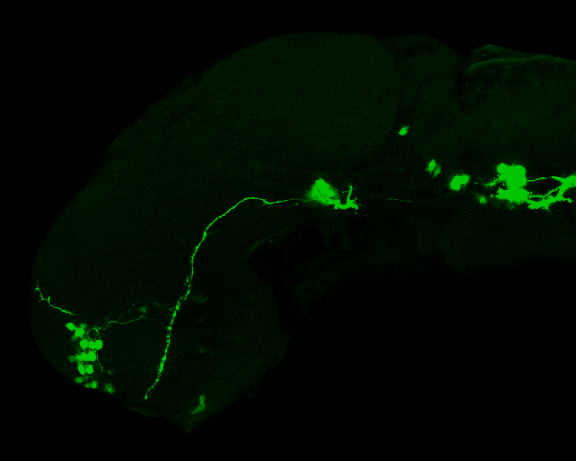 isl1:GFP lateral 1dpf