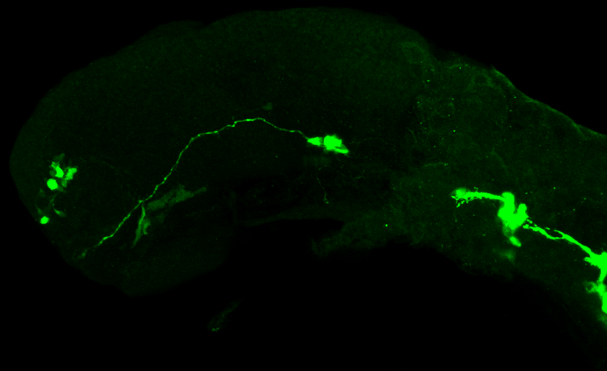 isl1:GFP lateral 1dpf 