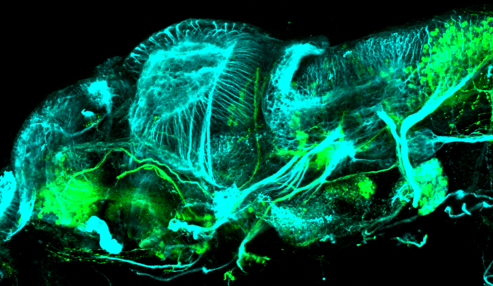 isl1:GFP lateral 4dpf with tubulin(cyan)