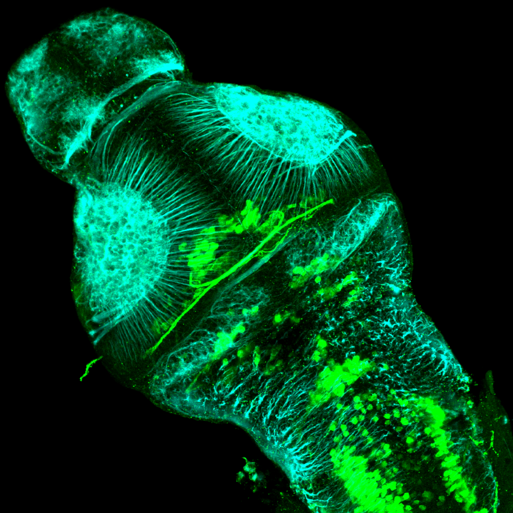 isl1:GFP 3dpf dorsal with tubulin(cyan)