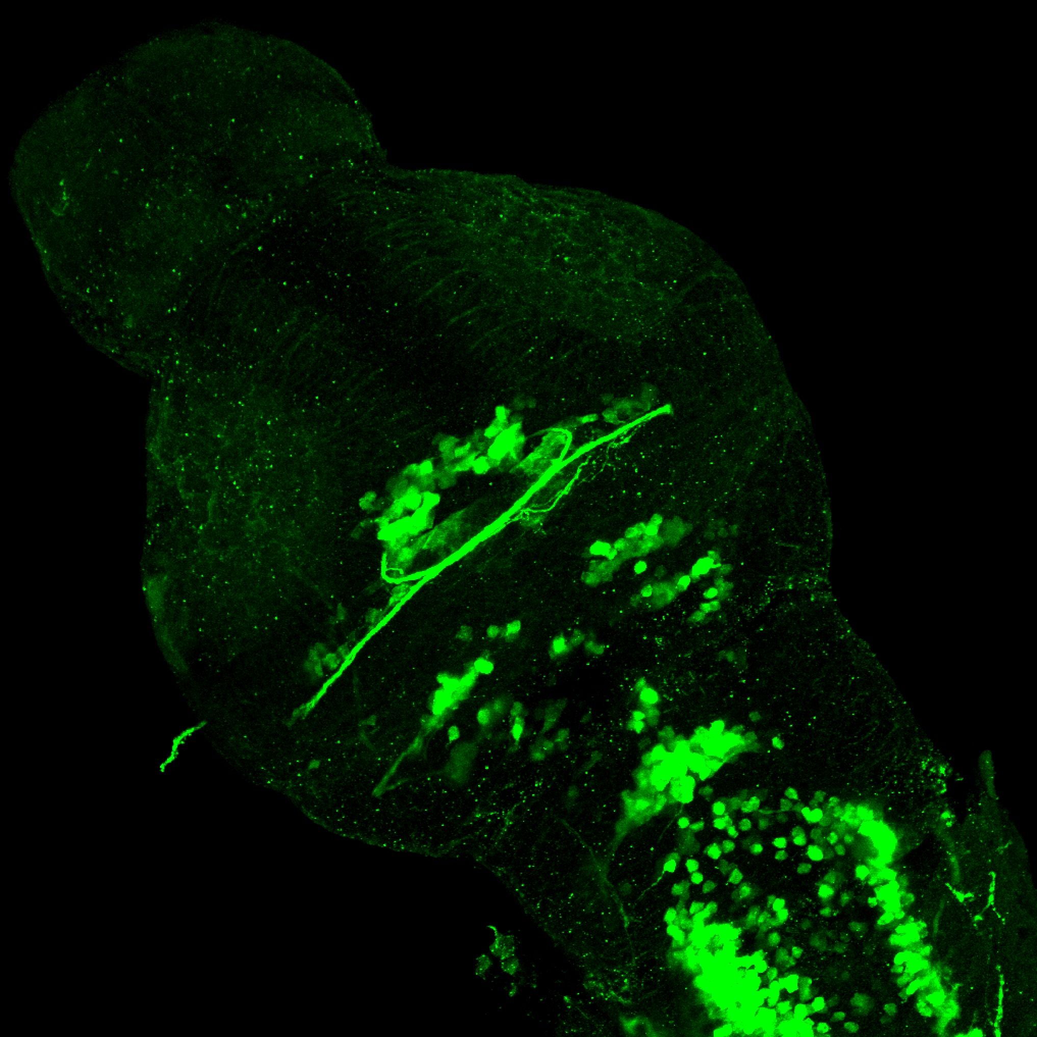 isl1:GFP 3dpf dorsal 