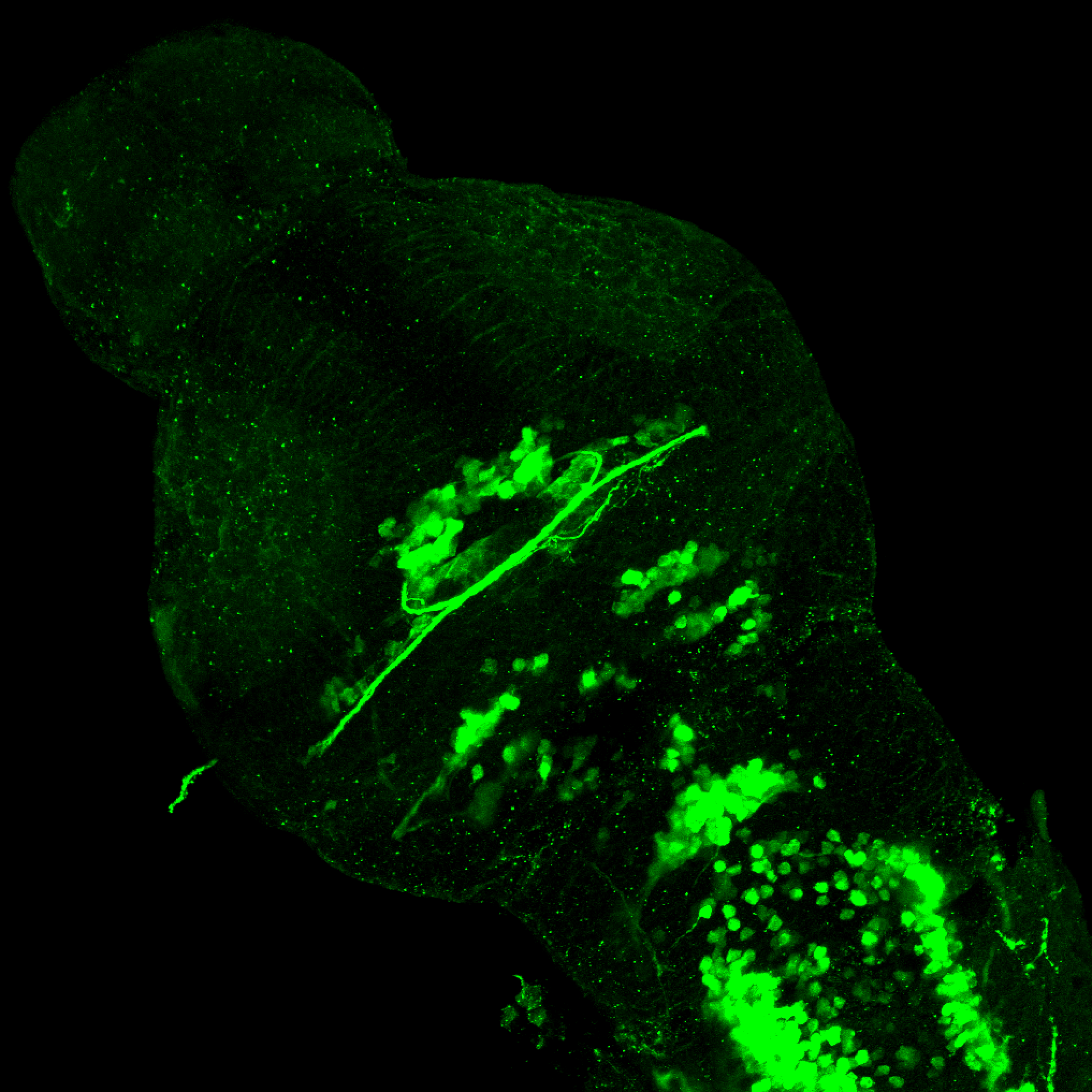 isl1:GFP 3dpf dorsal