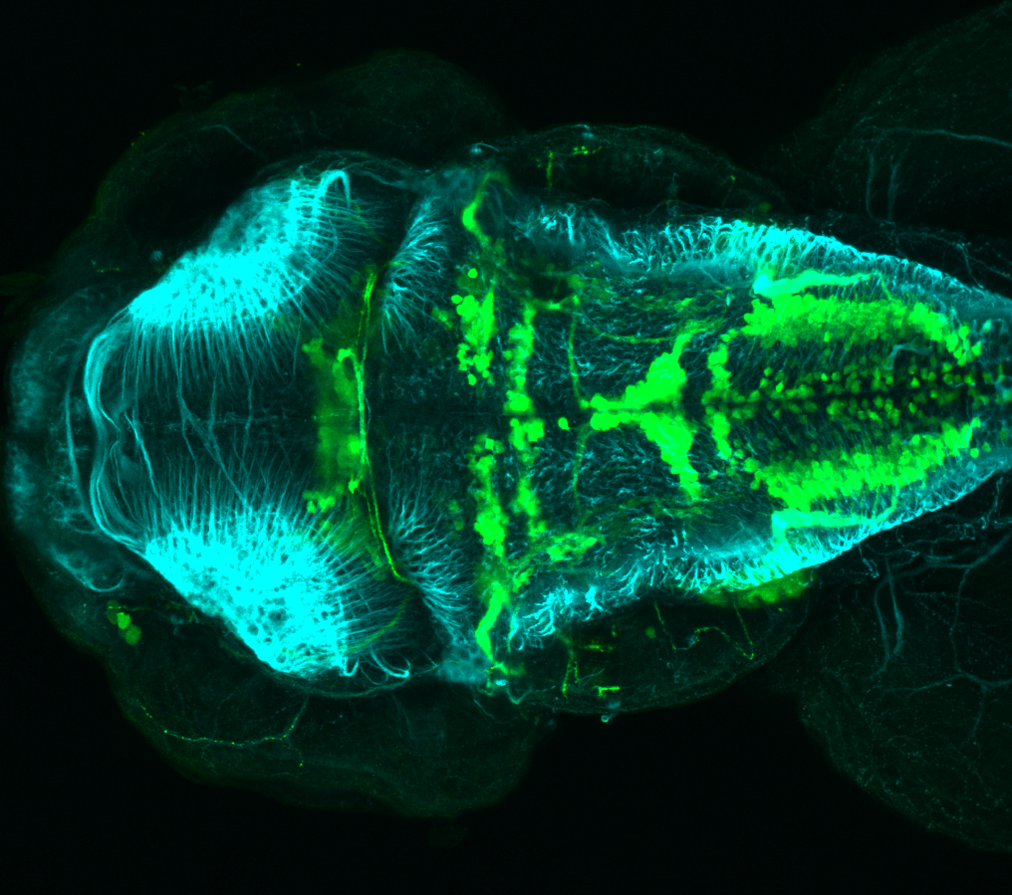 isl1:GFP 60hpf dorsal with tubulin (cyan)