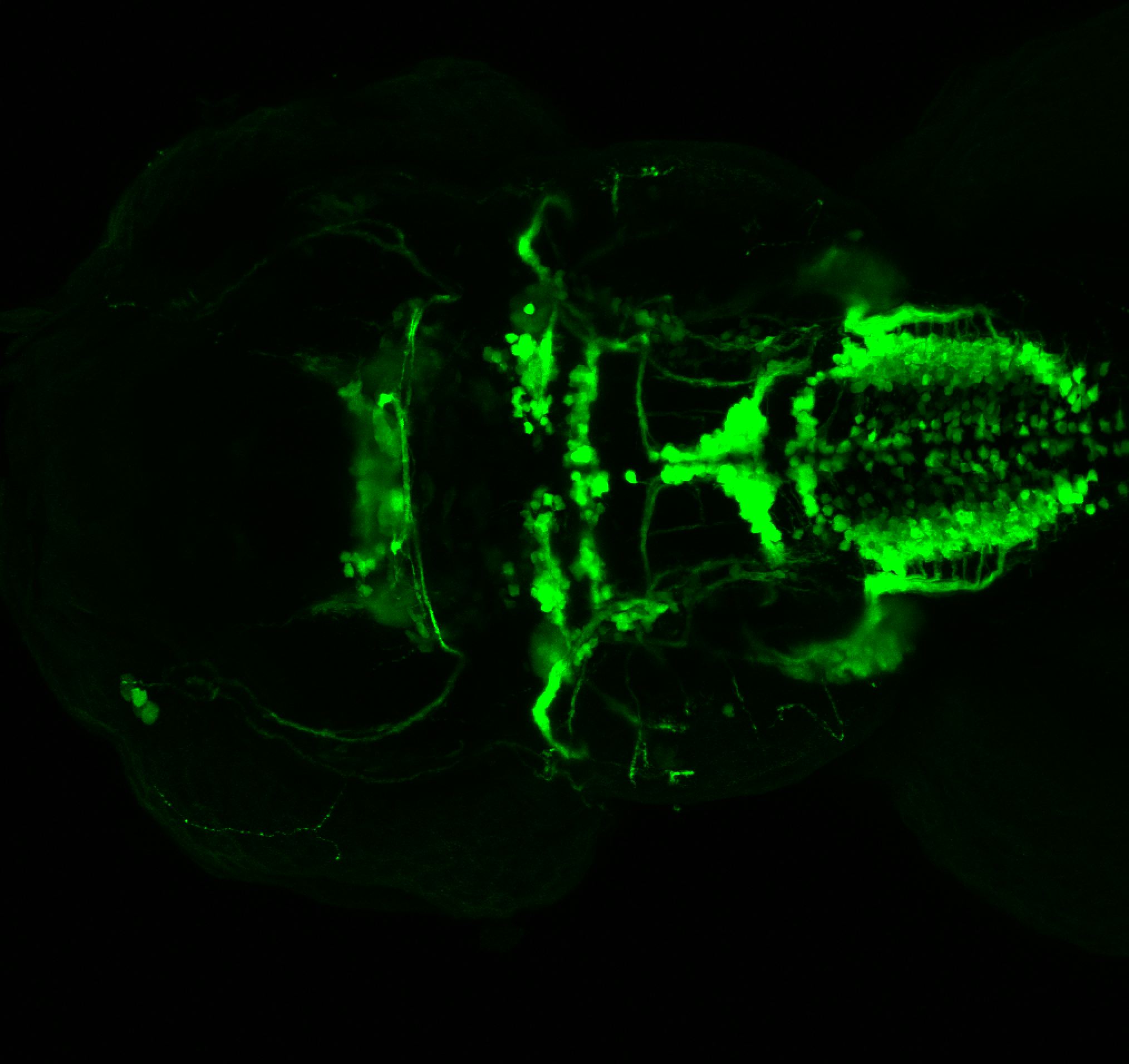 isl1:GFP 60hpf dorsal 