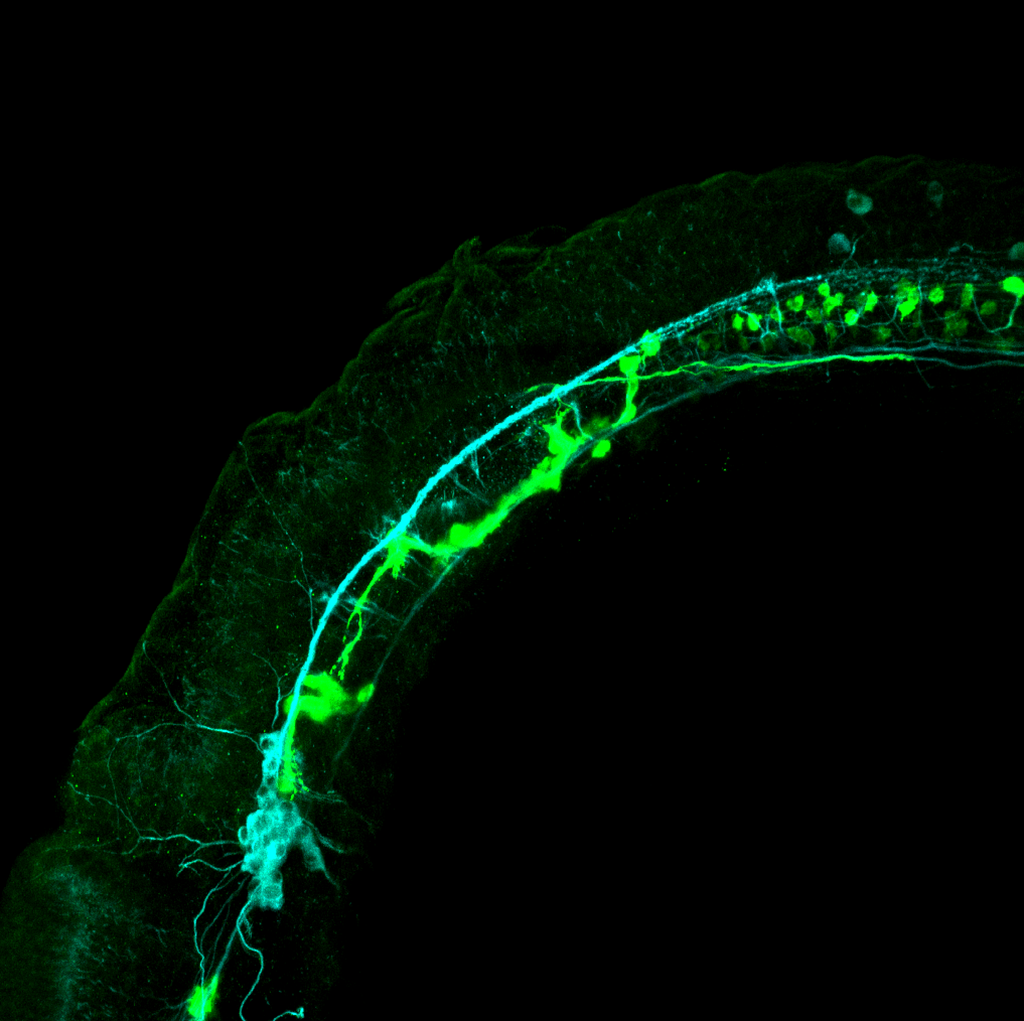 isl1:GFP lateral 1dpf with tubulin (cyan)