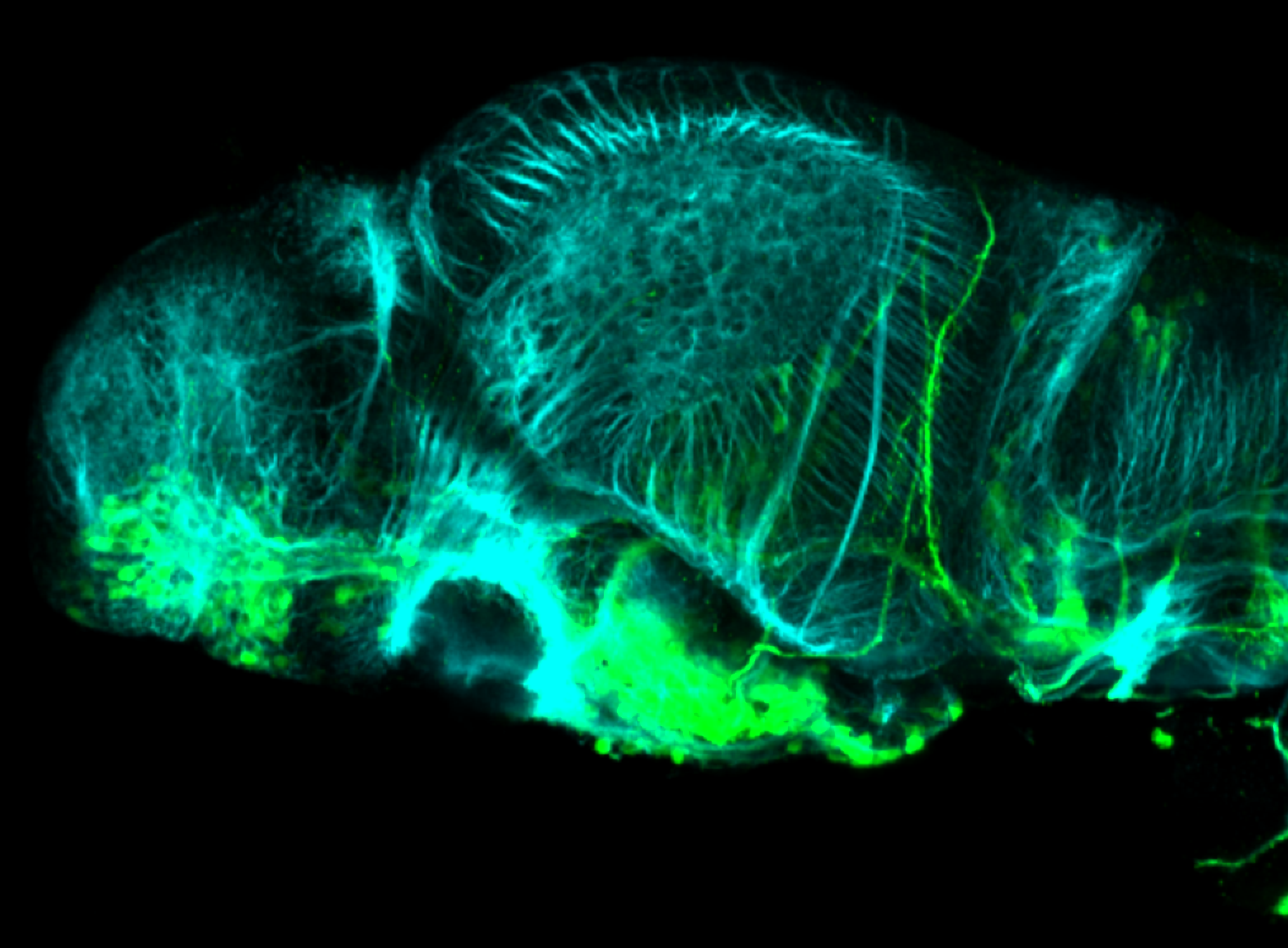 isl1:GFP 3dpf lateral forebrain with tubulin(cyan)