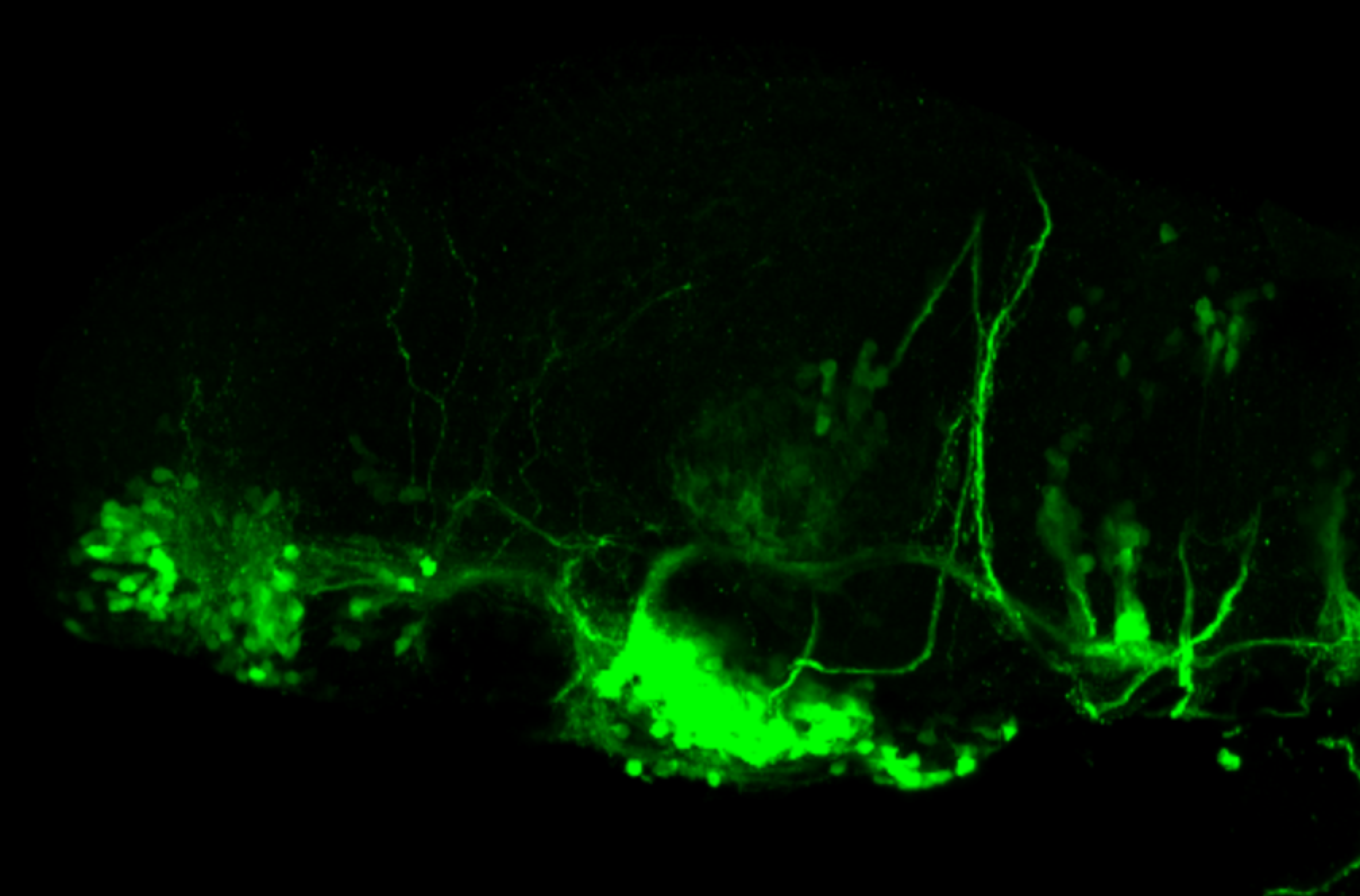 isl1:GFP 3dpf lateral forebrain 