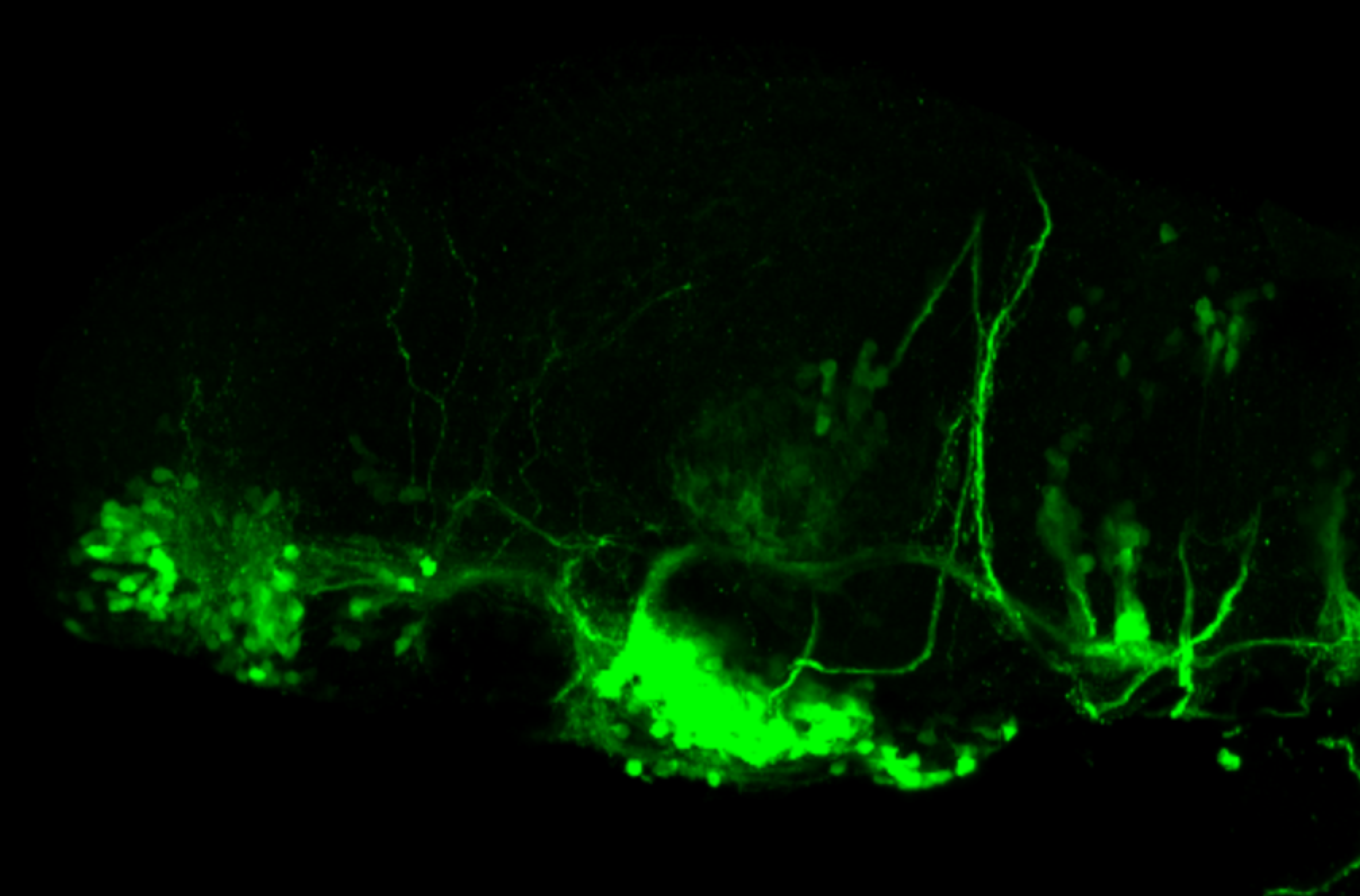 isl1:GFP 3dpf lateral forebrain