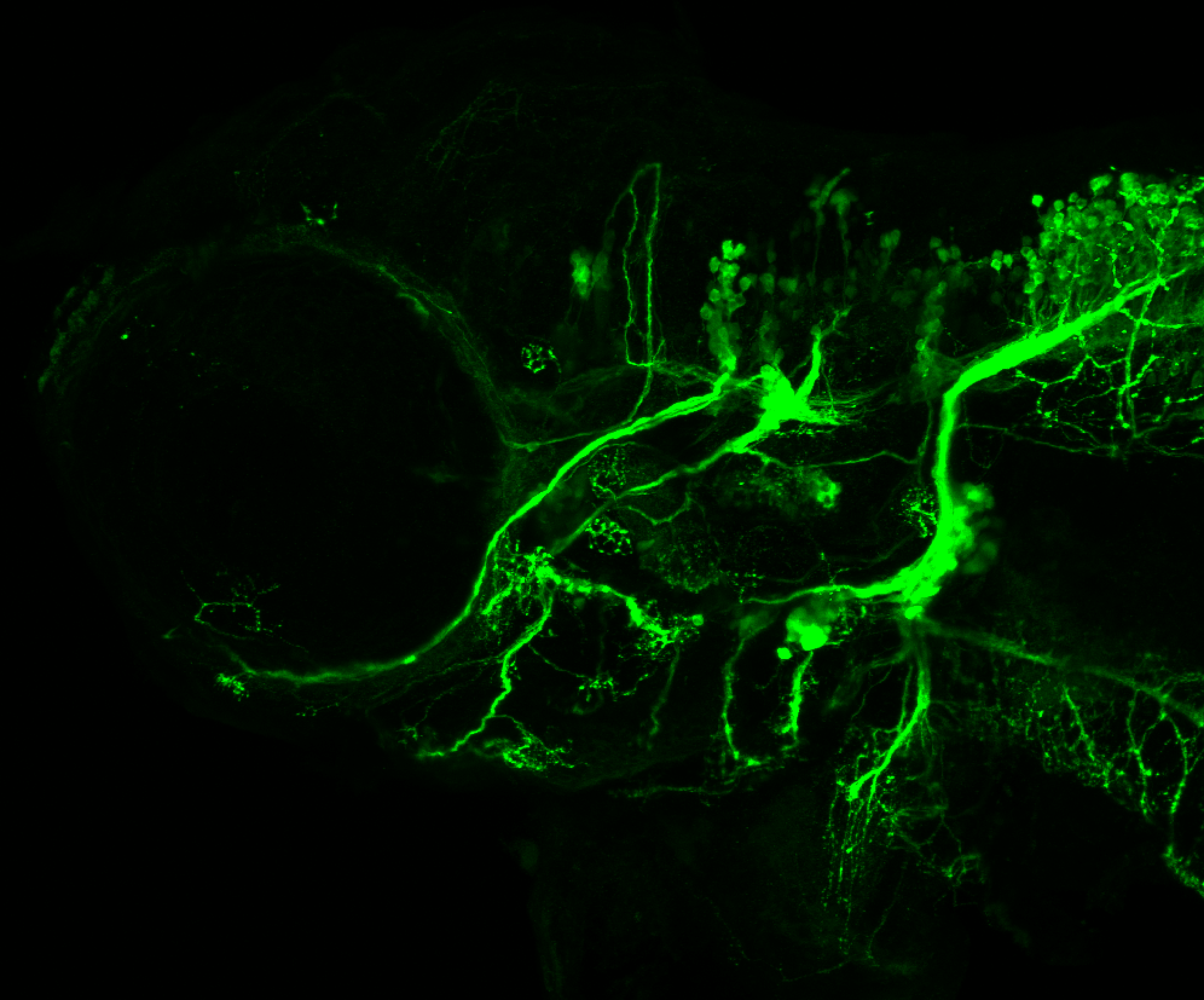 isl1:GFP 60hpf lateral 