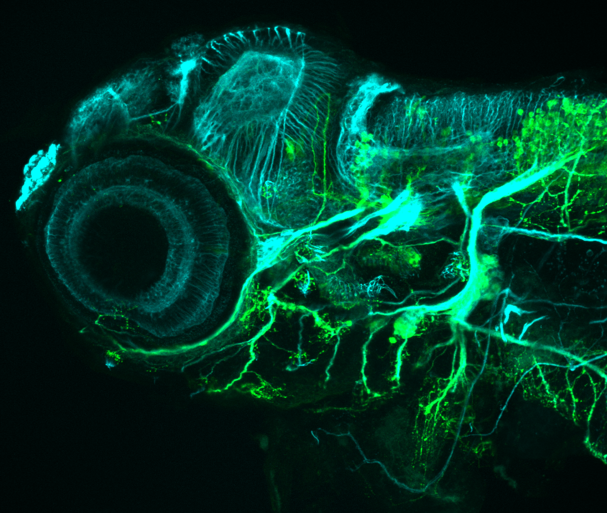 isl1:GFP 60hpf lateral with tubulin (cyan)