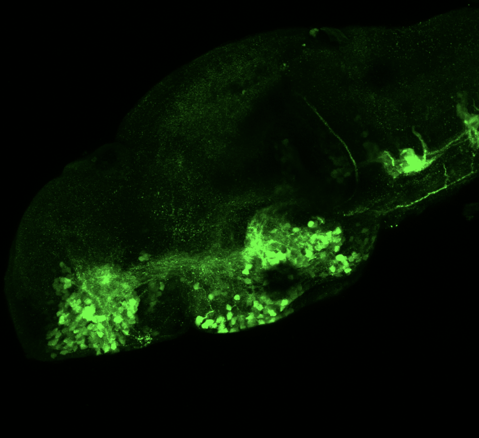 isl1:GFP lateral 5dpf 