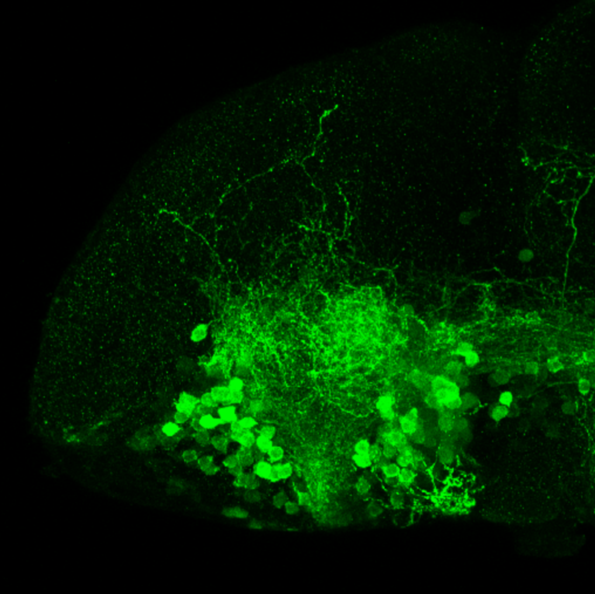 isl1:GFP 7dpf lateral forebrain