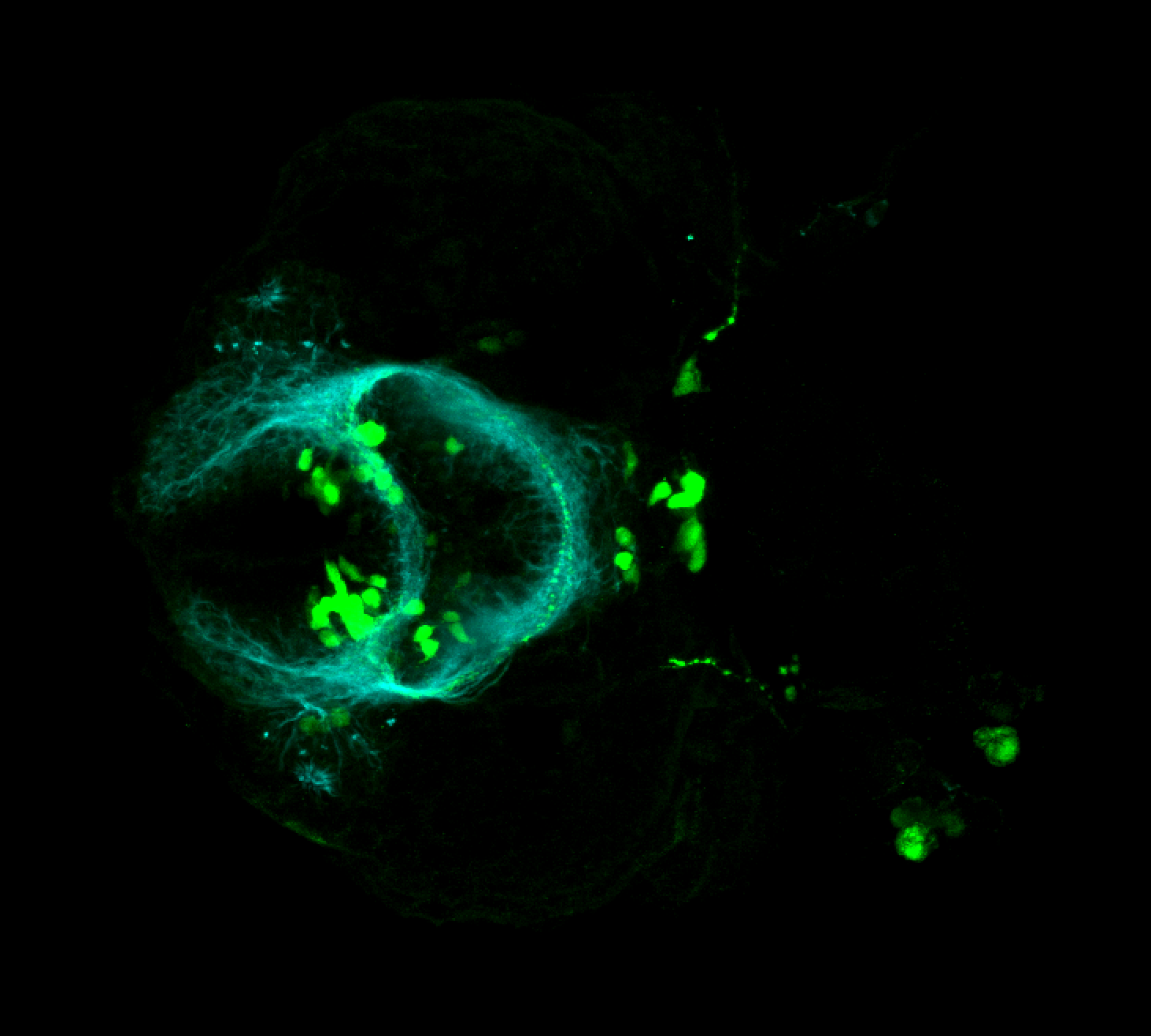 isl1:GFP ventral 36hpf 