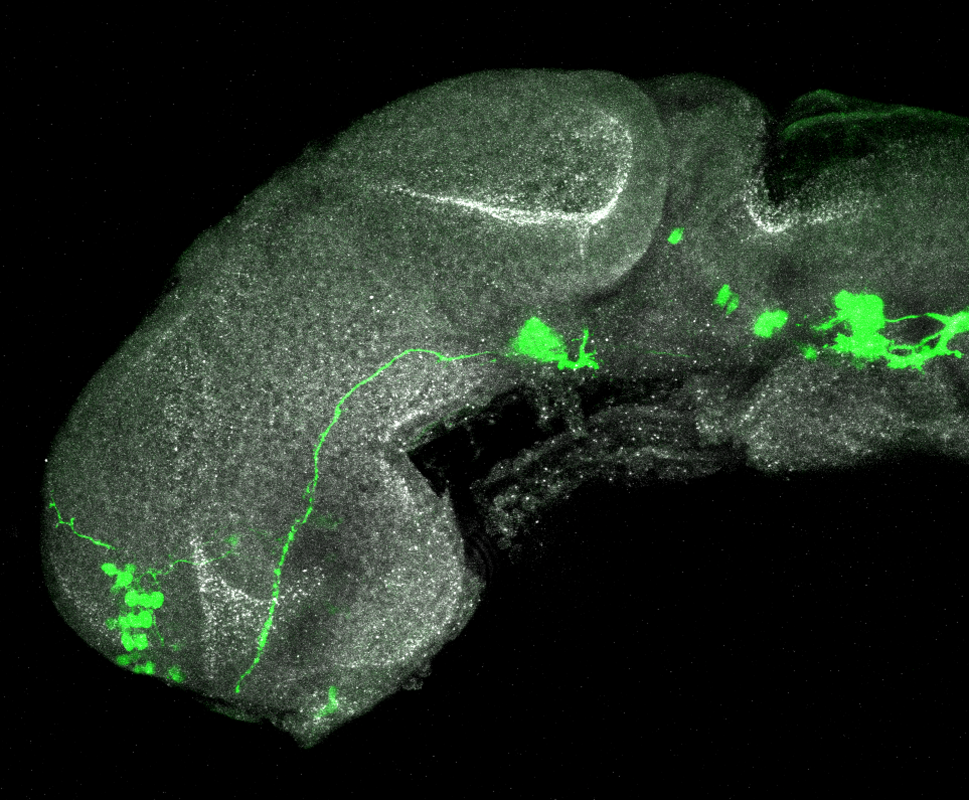 isl1:GFP lateral 1dpf with ZO1(grey)