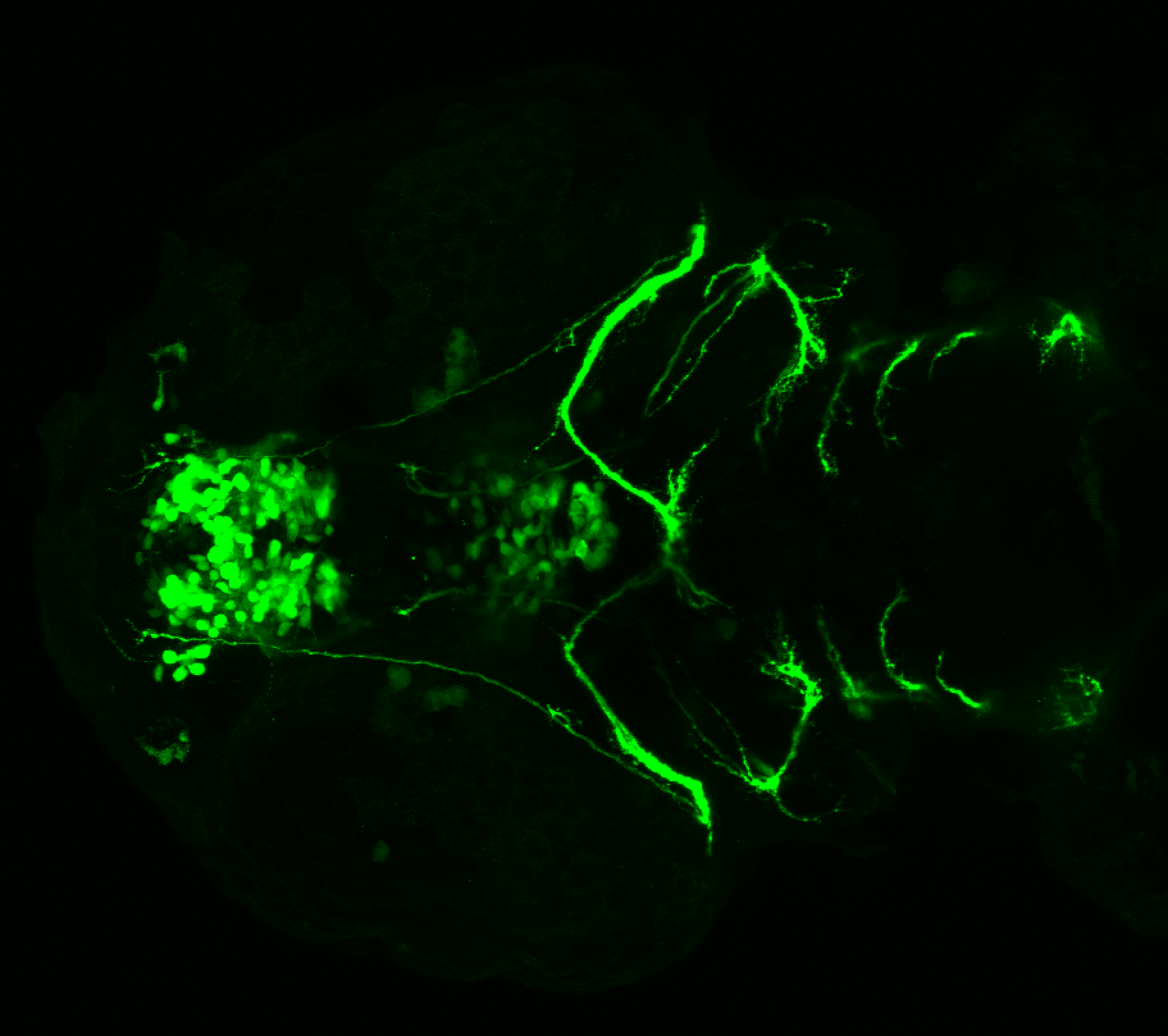 isl1:GFP 60hpf ventral