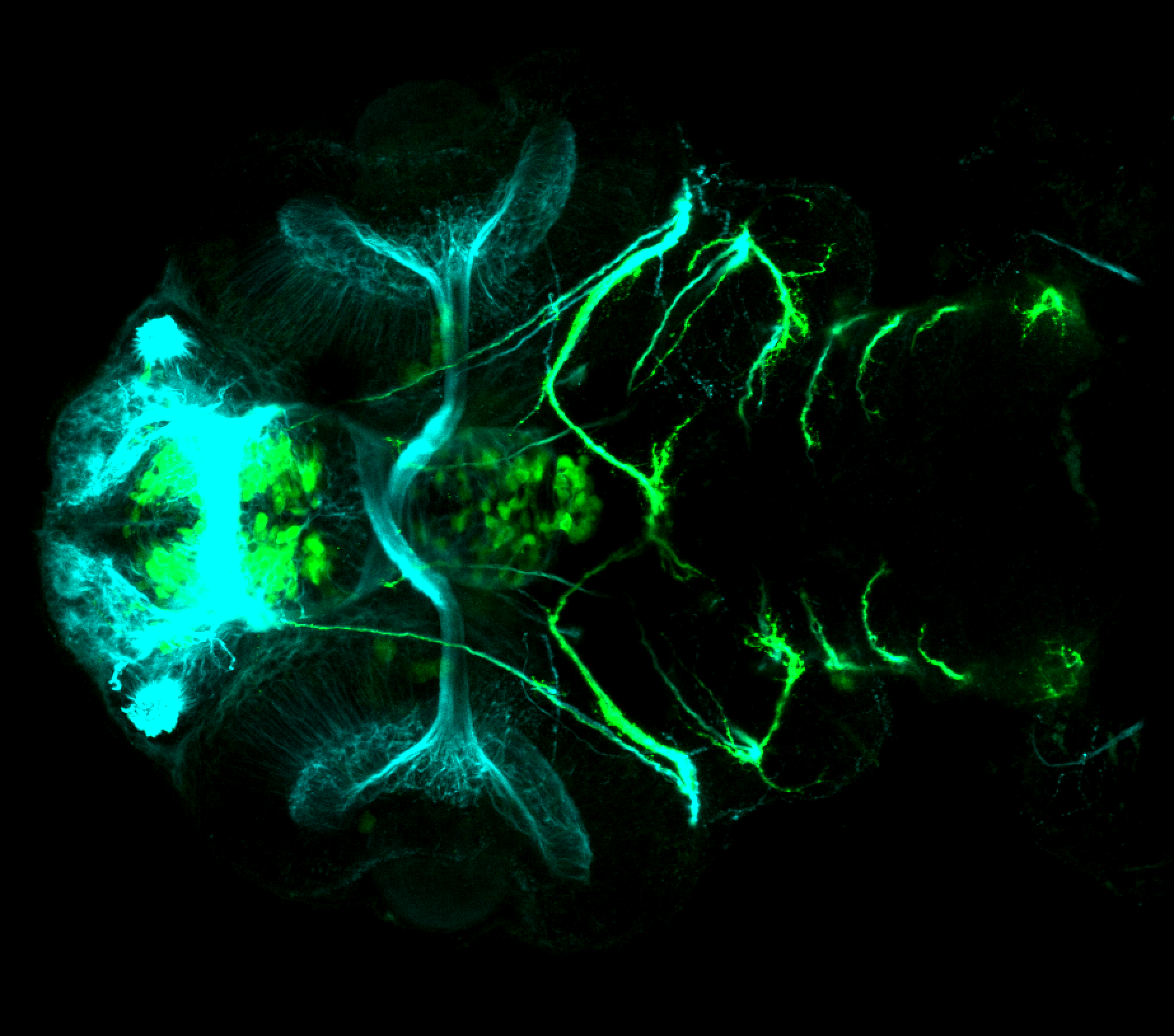 isl1:GFP 60hpf ventral with tubulin (cyan